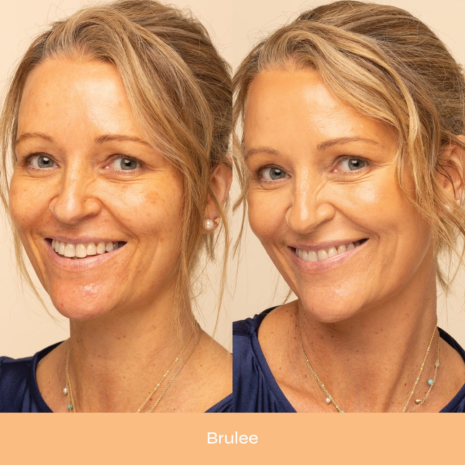 Dewy Bounce Radiant, Lightweight & Hydrating Skin Tint SPF 30